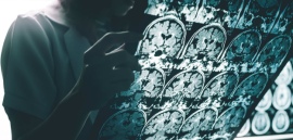 FDA одобрило постепенное увеличение дозы препарата от болезни Альцгеймера Kisunla (Eli Lilly)